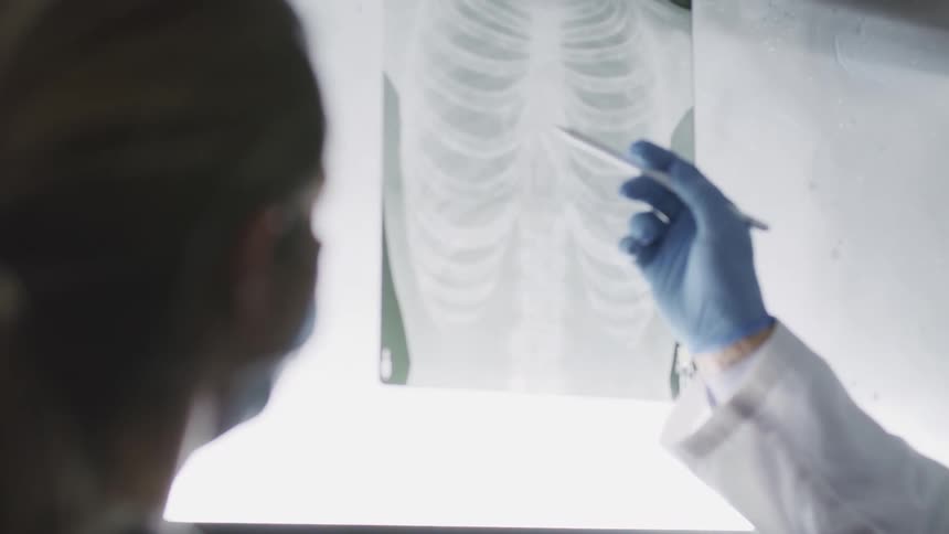 A doctor is pointing at an xray display