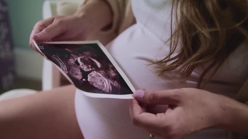 A woman looks at a photo of her baby on an ultrasound