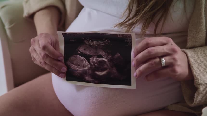 Pregnant woman sits on couch showing ultrasound picture