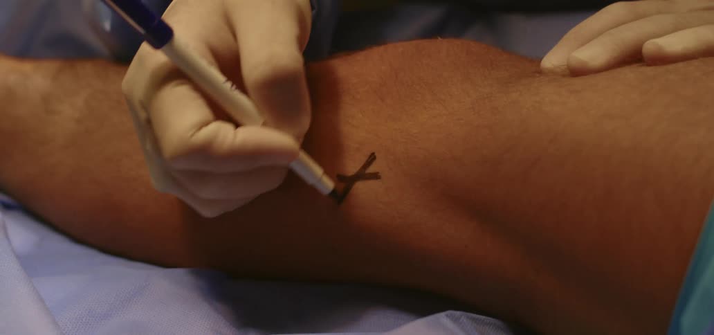 A surgeon is marking an incision with a marker
