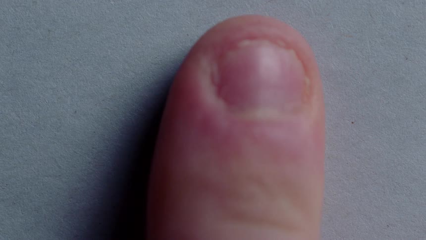 Persons finger gets its finger on a piece of paper