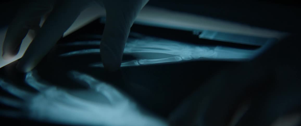 A person examines an x-ray film