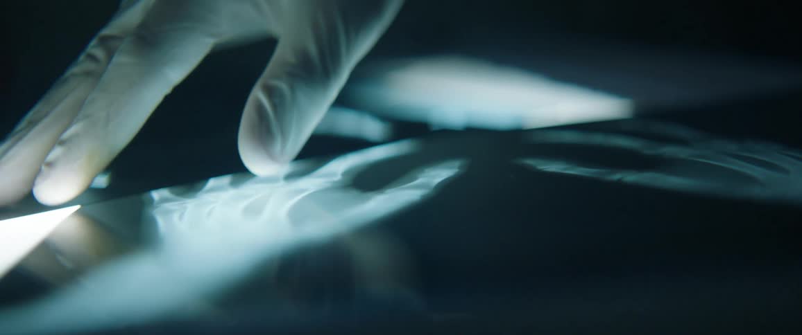 A person wearing latex gloves adjusts an x-ray film