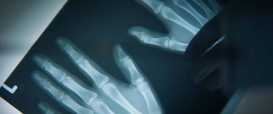 Someone looks at an x-ray of hands