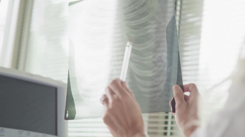 A doctor points to an xray