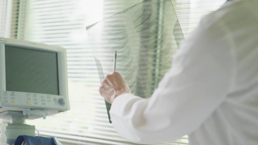 A medical professional in a white lab coat points towards an xray image of a rib cage