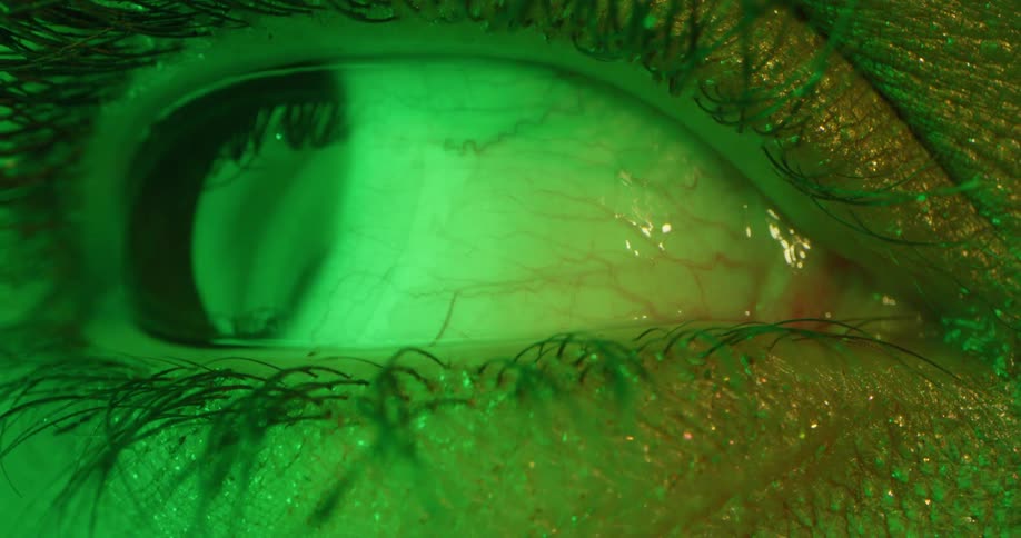 Close up of an eye blinking