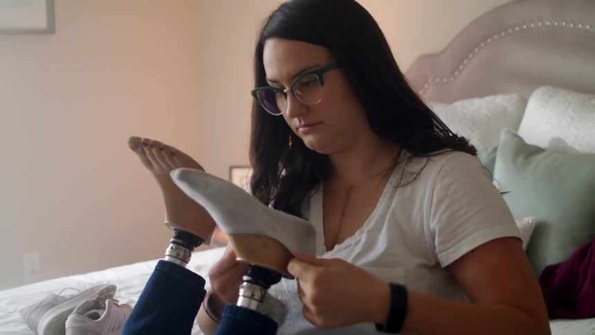 A female caucasian is placing socks on her prosthetic feet