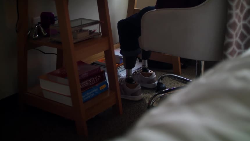 A person with prosthetic legs sits in a chair at home