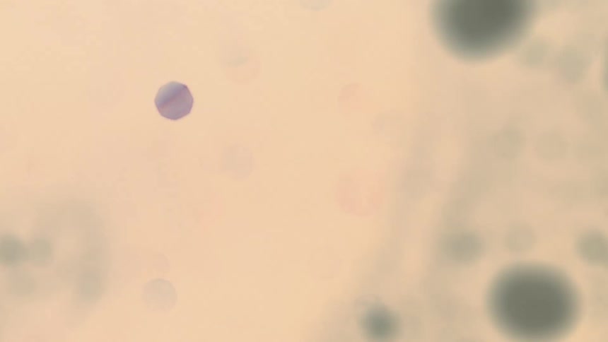 Movement of abstract dots