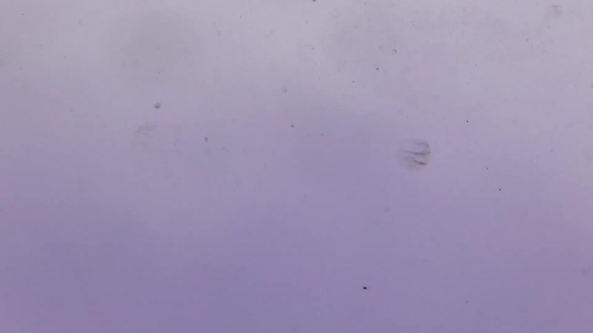 Particles floating in cloudy liquid
