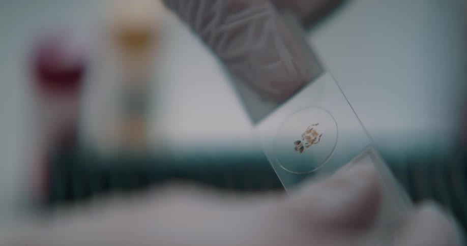 Lab technician wearing latex gloves handles blood samples in microscope slides