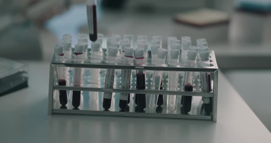 A person takes a test tube of blood out of a rack