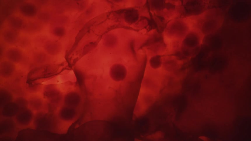 Dark balls floating in liquid near filmlike material that move back and forth