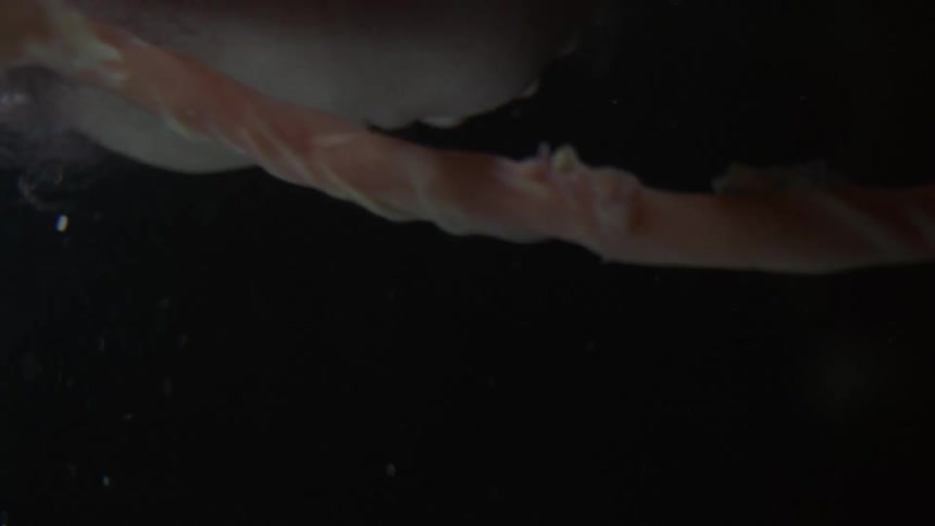 Unborn baby with the umbilical cord in the womb