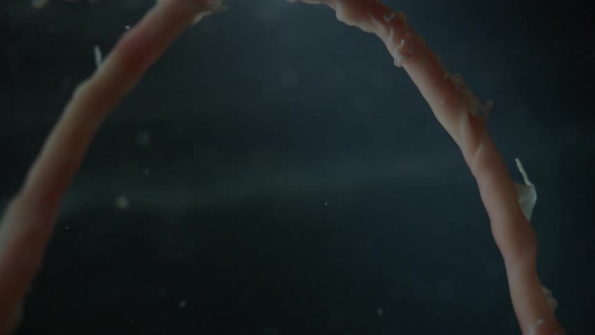 Babys umbilical cord connecting the baby to its mother in mothers womb