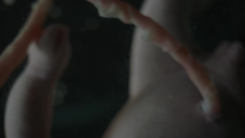 A fetus and umbilical cord floating in utero