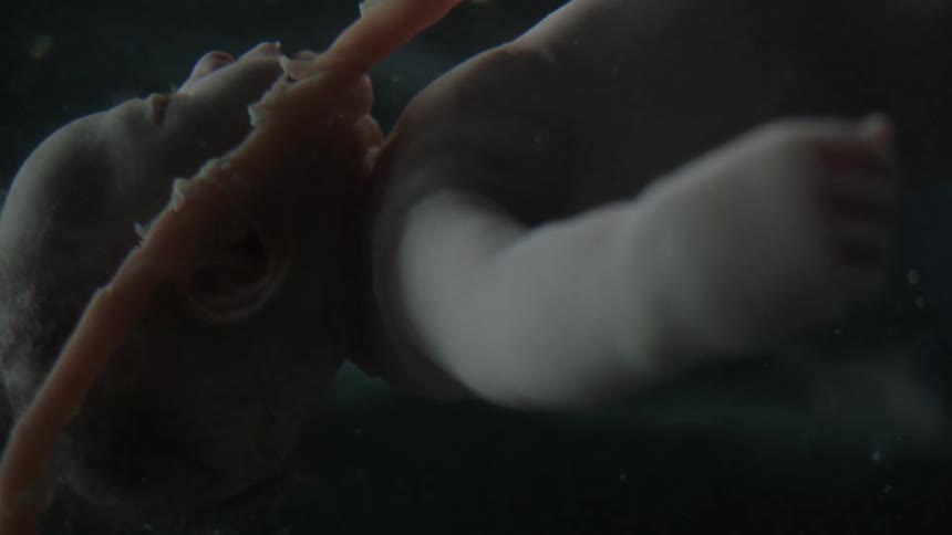 A fetus floats next to its umbilical cord within a uterus full of amniotic fluid