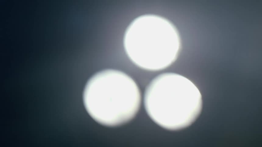A set of three surgical lights are shining above before abruptly turning off