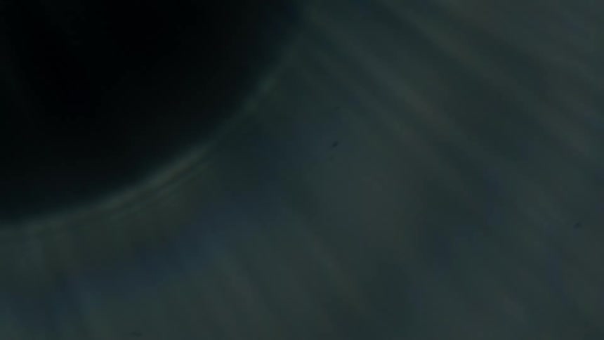 Concentric halos and parallel striations near dark opening