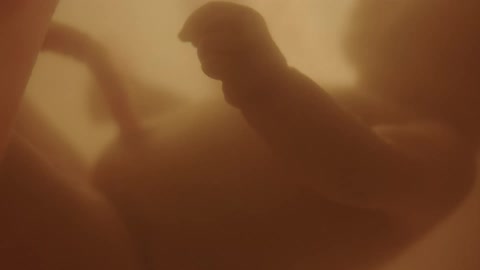 Unborn babys arms and umbilical cord in the womb
