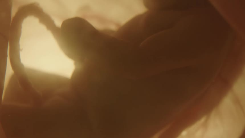 A baby is in utero in amniotic fluid