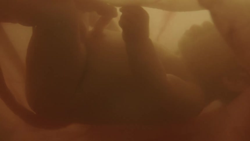 A fetus floating in utero