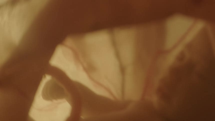 A fetus floating in utero