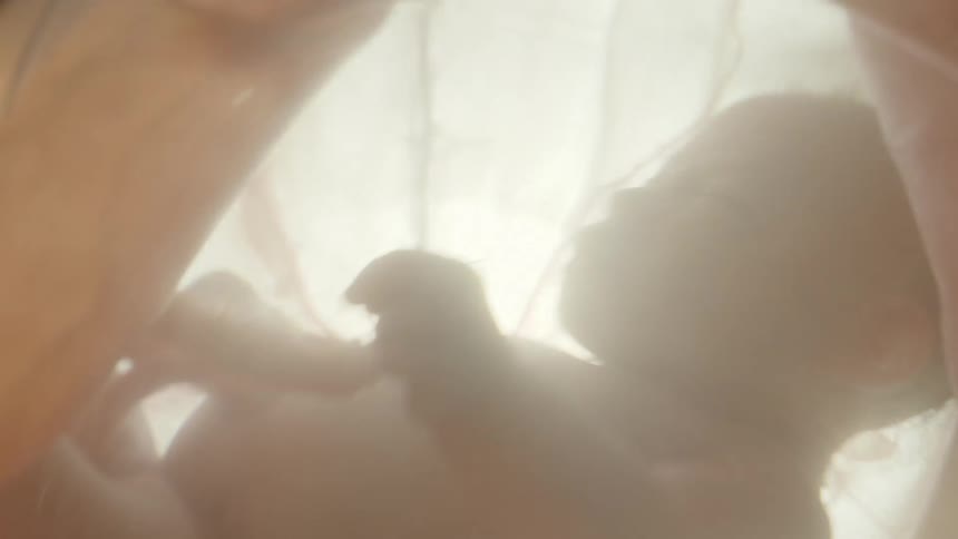 A fetus and umbilical cord in utero