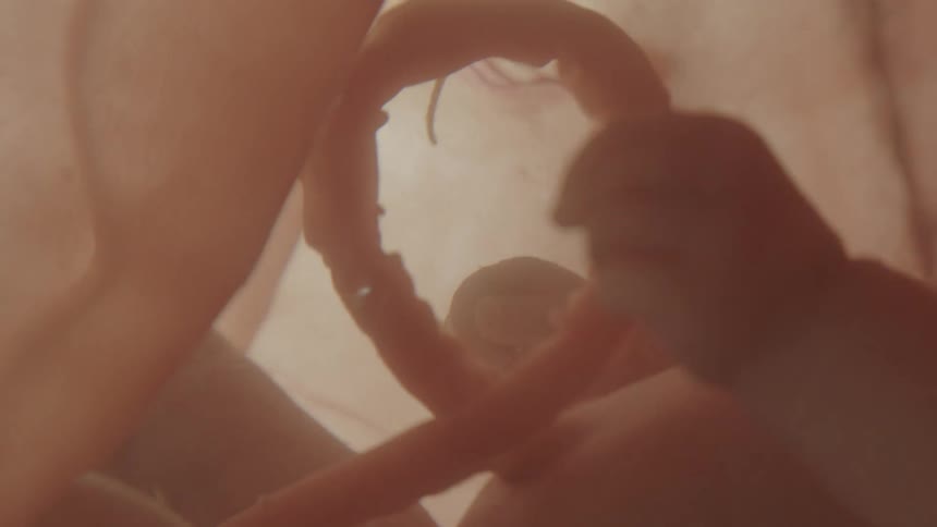 Developing limbs of a fetus and umbilical cord in the amniotic sac