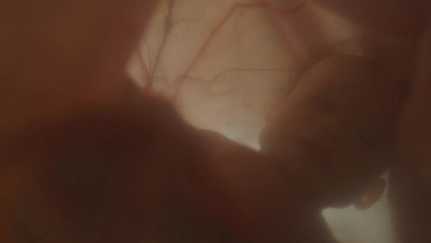 A fetus floating in utero