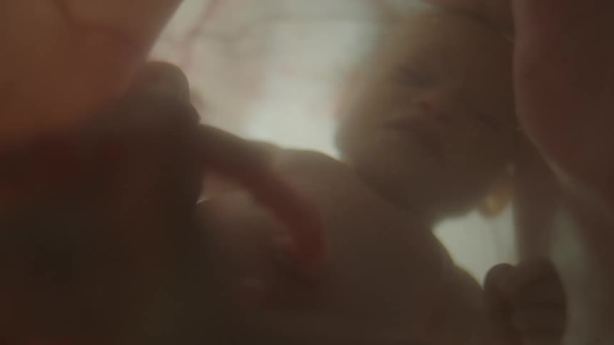 An unborn baby in a woman floats in liquid