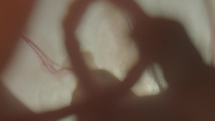 Unborn child and umbilical cord float in fluid