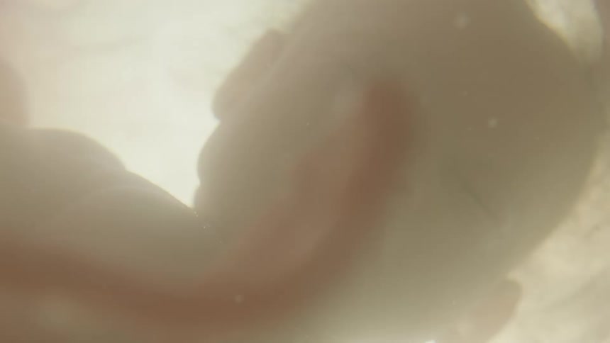 A developed fetus floats serenely in a uterus full of amniotic fluid