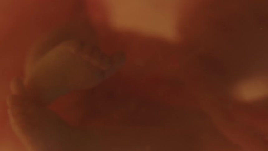 An unborn baby floats in liquid in the womb