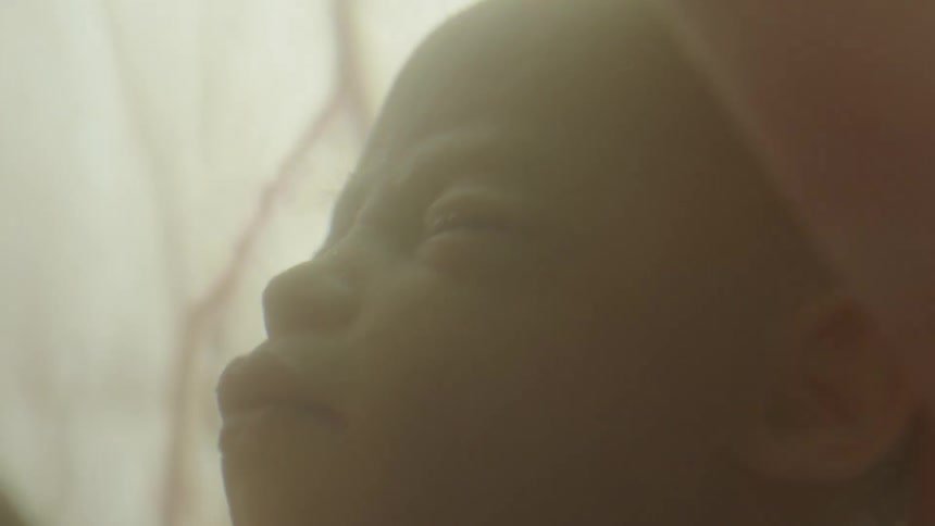 Close up of unborn babys face in the womb