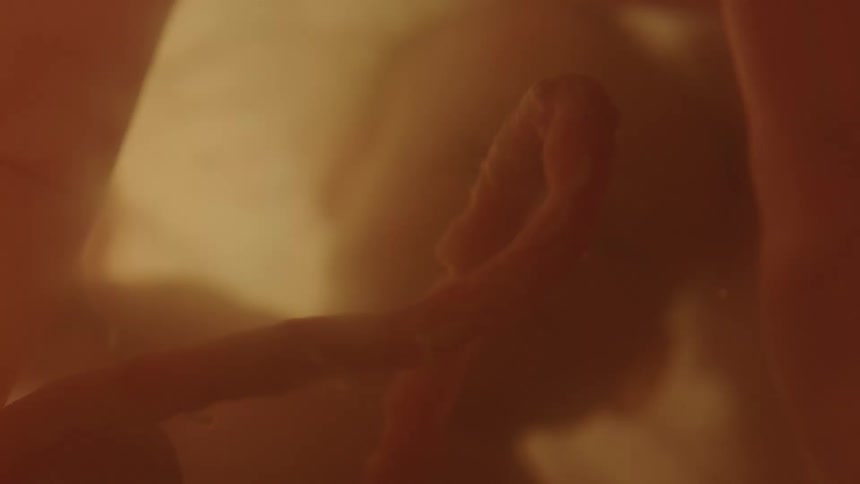 A fetus and umbilical cord floating in utero