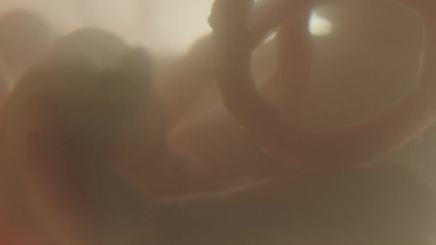 Unborn baby floating in gestational fluid is back lit by light