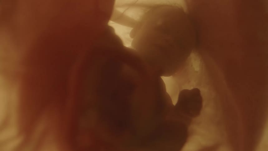 A fetus floating in utero