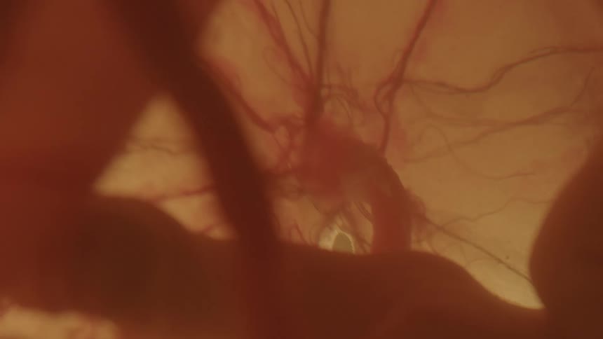 A developing baby rests peacefully inside of a uterus full of amniotic fluid