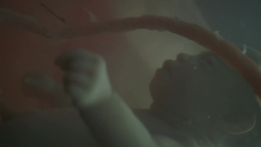 Baby floats in cloudy fluid as light brightens area
