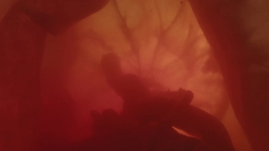 A fetus in the womb