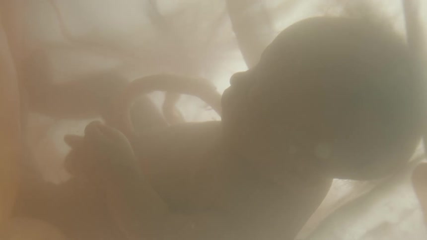Unborn baby with umbilical cord in mothers womb