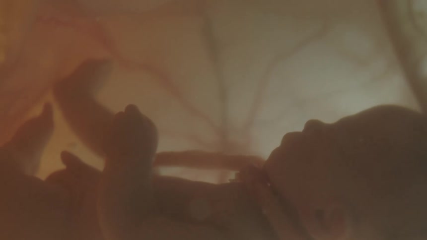 A baby is in amniotic fluid with full body visible as well as the umbilical cord