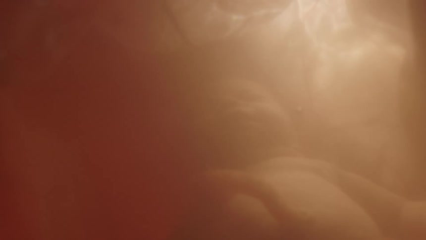 Unborn baby floats in gestational sack