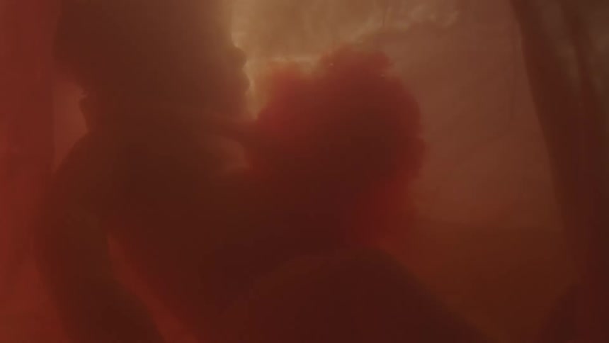 Entanglement of the cord wrapping around the babys neck in mothers womb
