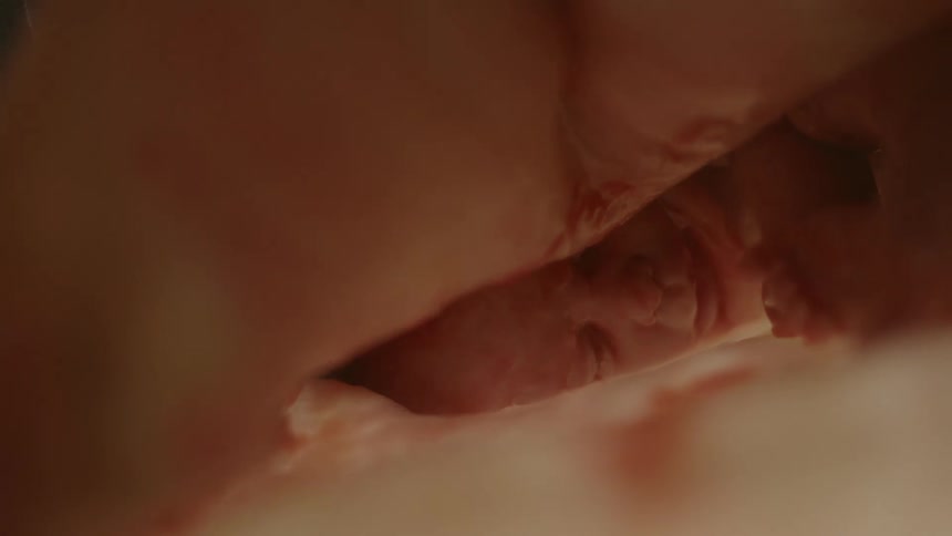 Baby moves around in gestational sack