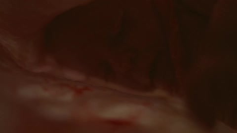A fetus floating in a uterus has its umbilical cord around its neck