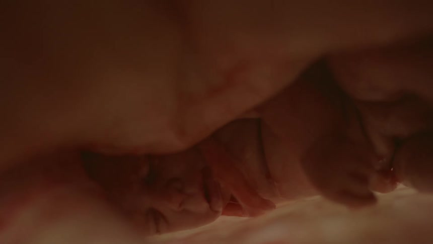 An unborn baby with the cord wrapped around its face