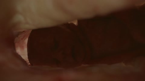Umbilical cord wrapped around babys neck in mothers womb
